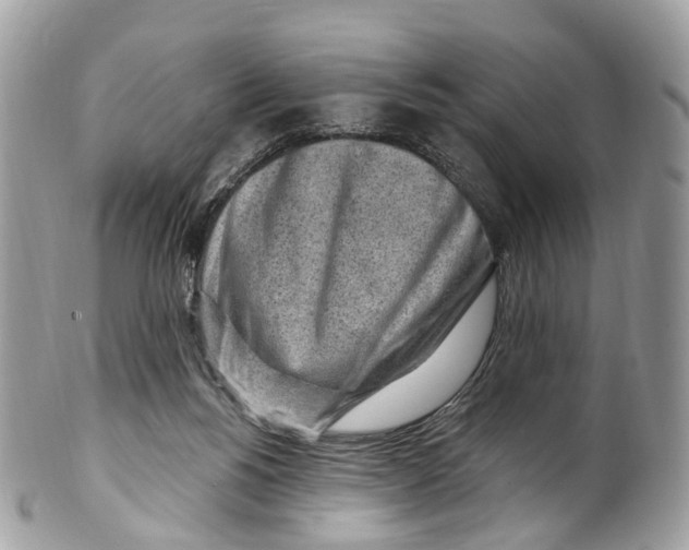 X0000099520168200806051220