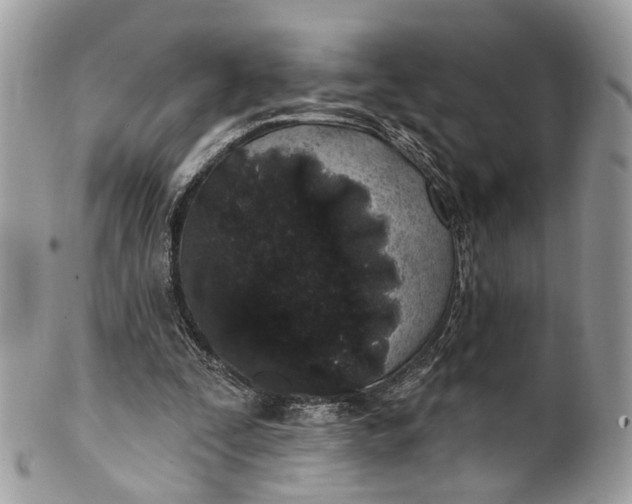 X0000099520295200806051217