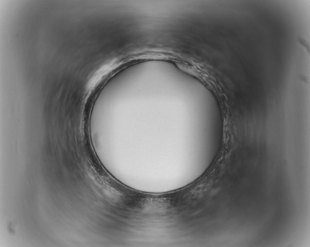 X0000099520296200806051217