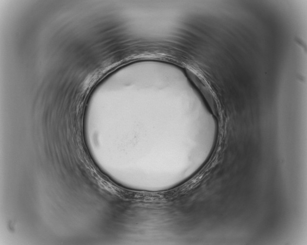 X0000099520337200806051216