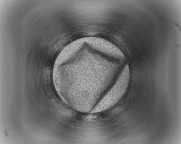 X0000099520366200806051217