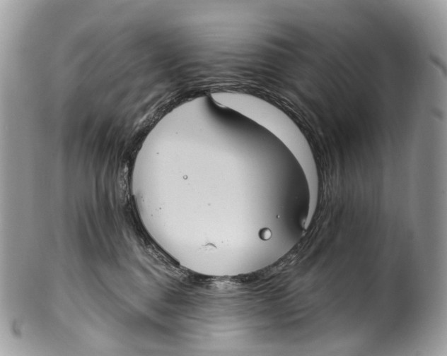 X0000099520376200806051217