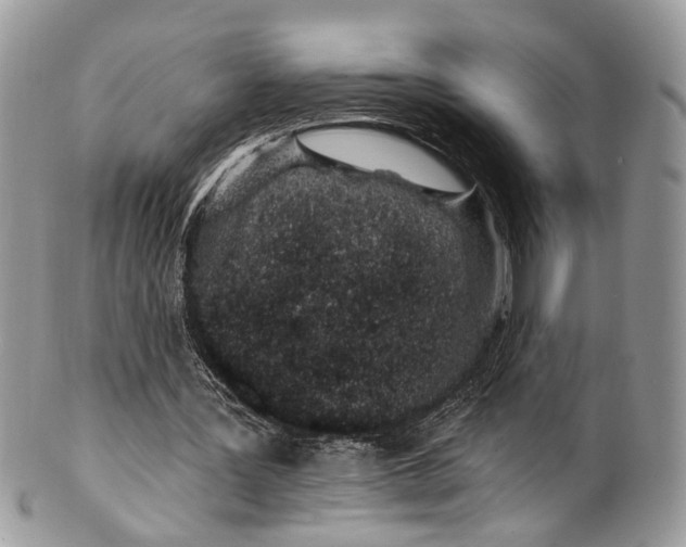 X0000099520387200806051216