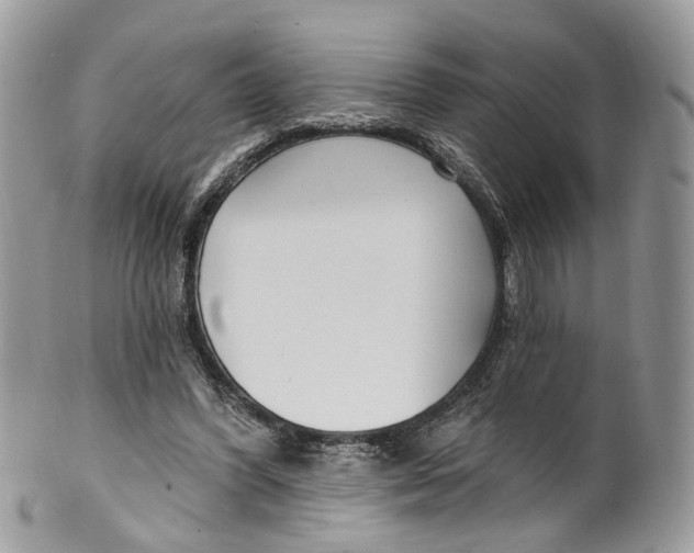 X0000099520396200806051216