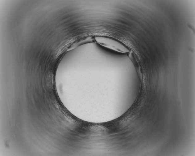 X0000099520397200806051216