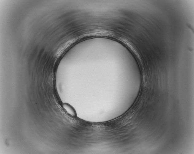 X0000099520437200806051215