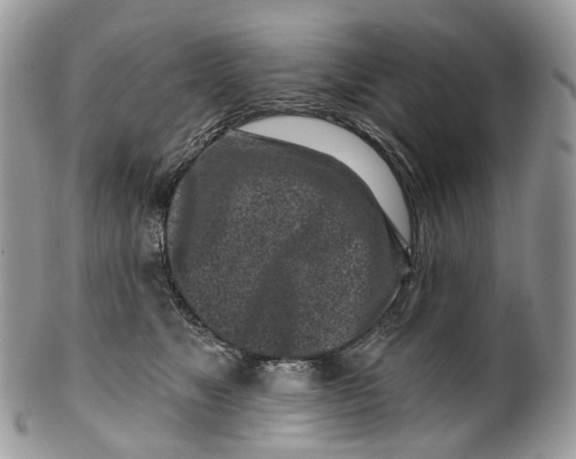 X0000099520517200806051214