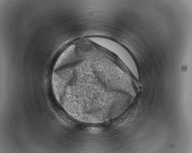 X0000099520352200806121507