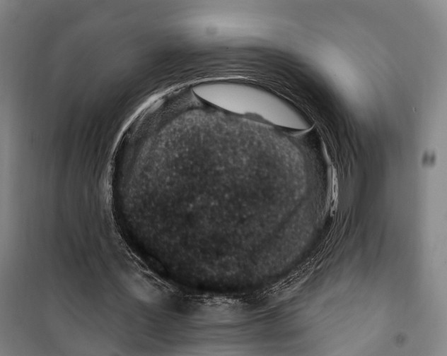 X0000099520387200806121506