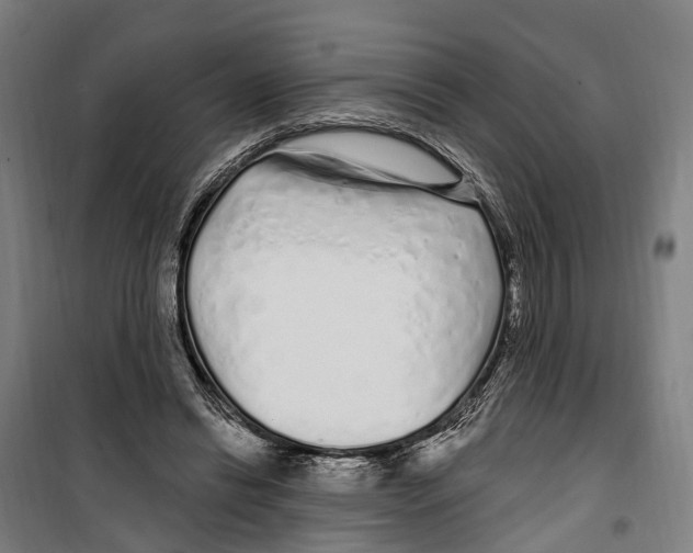 X0000099520446200806121505