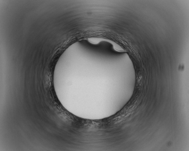 X0000099520772200806121501