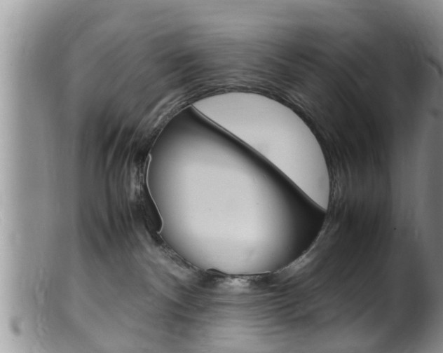 X0000099530140200805160734