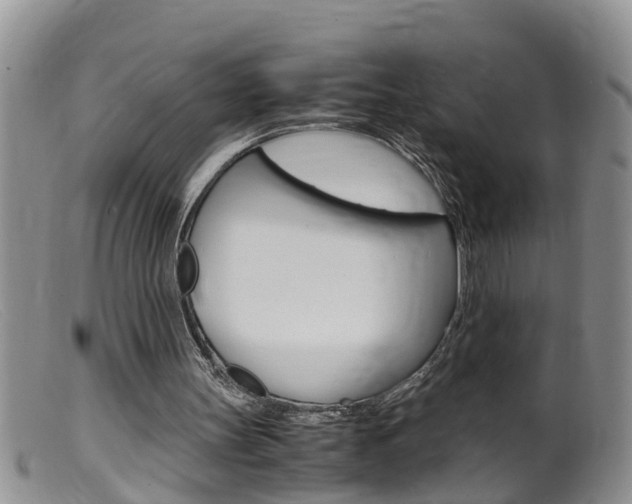 X0000099530147200805160733
