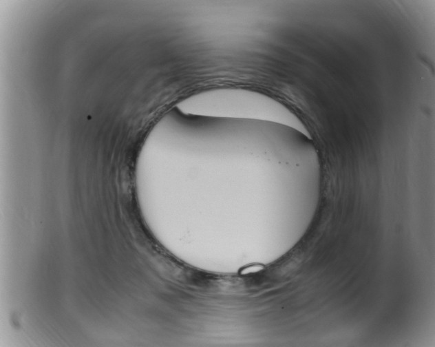 X0000099530317200805160731