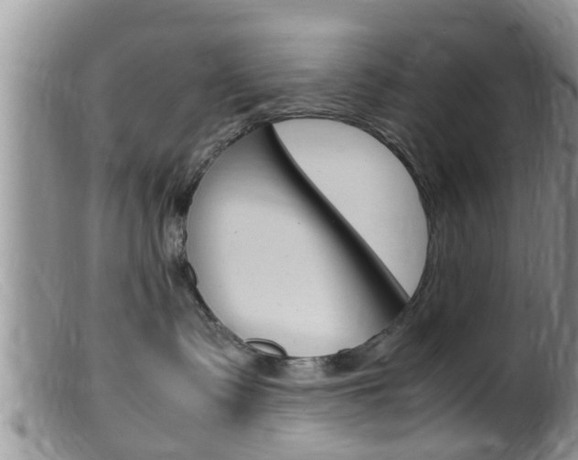 X0000099530335200805160731