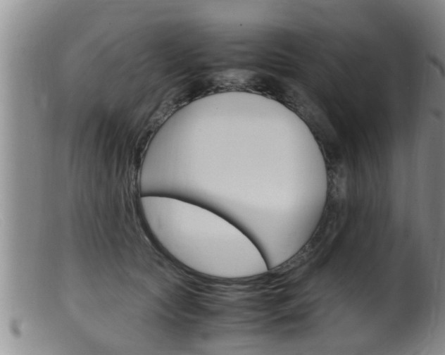 X0000099530561200805160728