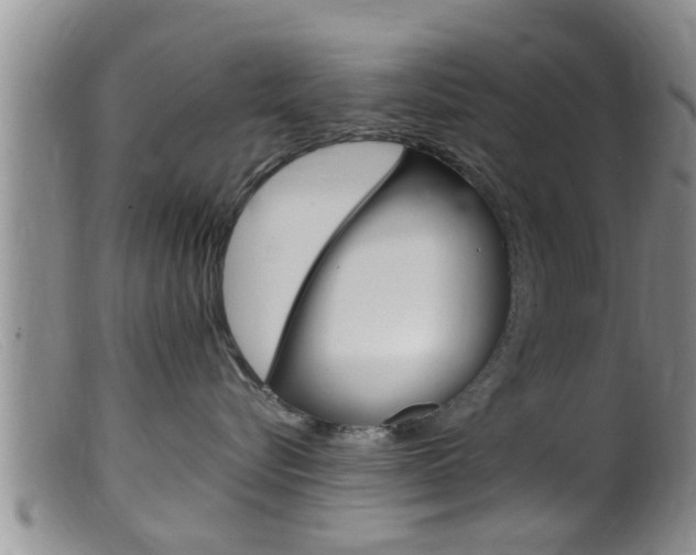 X0000099530576200805160728
