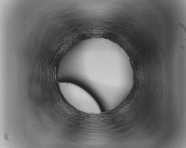 X0000099530818200805160723