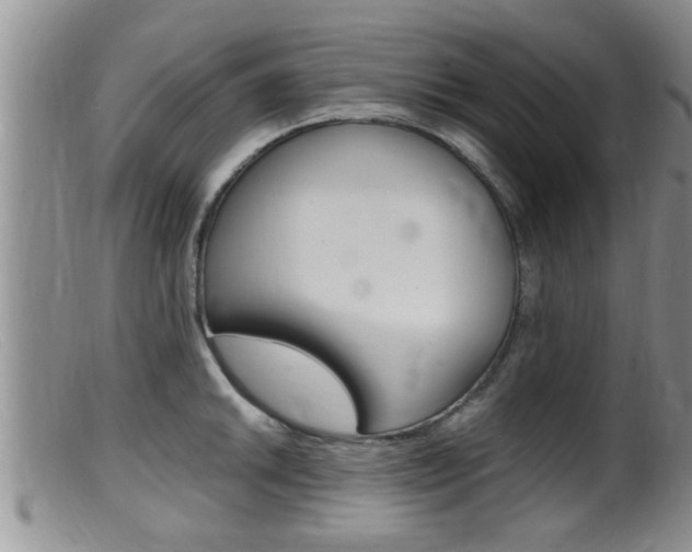 X0000099531046200805160720