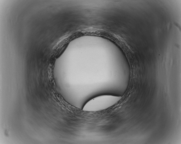 X0000099531350200805160715