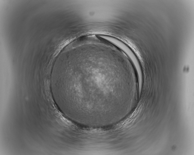 X0000099530385200805161217