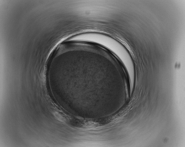 X0000099530387200805161217