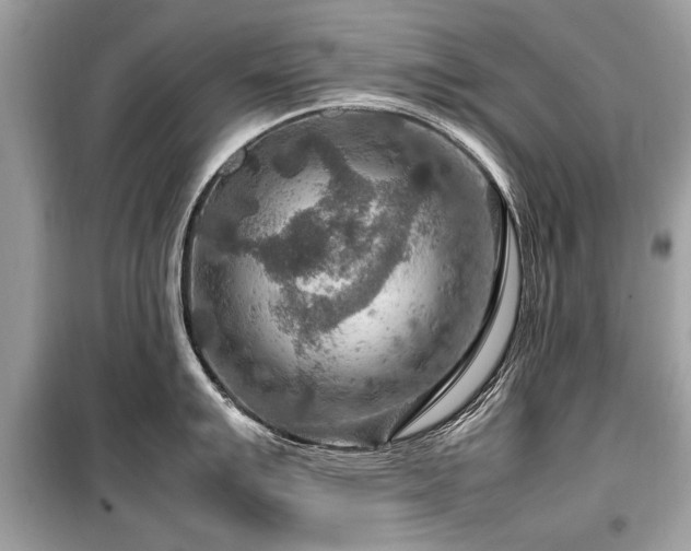 X0000099531007200805161207