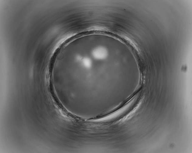 X0000099531117200805161204