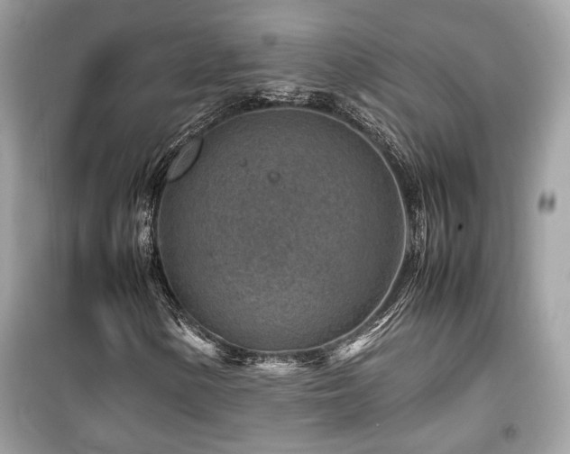 X0000099531154200805161204
