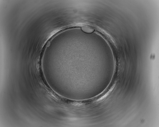 X0000099531170200805161204
