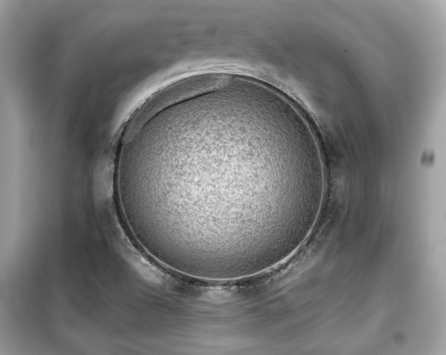 X0000099531504200805161158