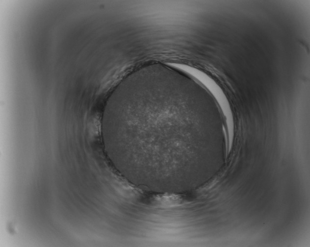 X0000099530517200805231105