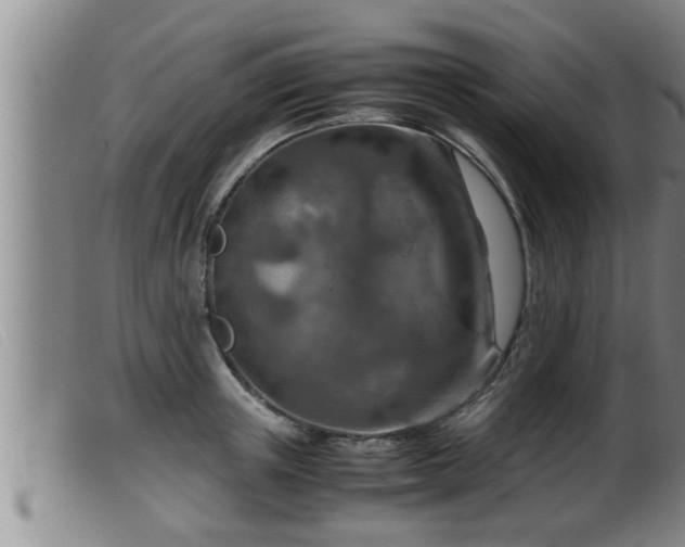 X0000099530851200805231100
