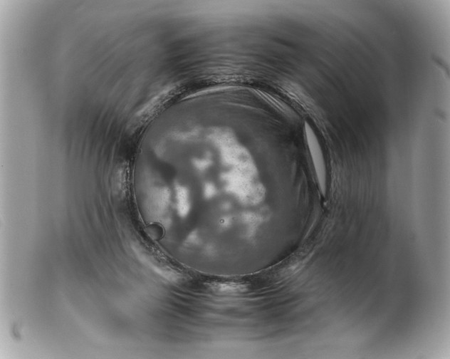 X0000099530165200805301447