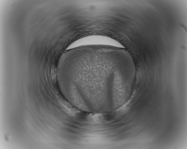 X0000099530186200805301447