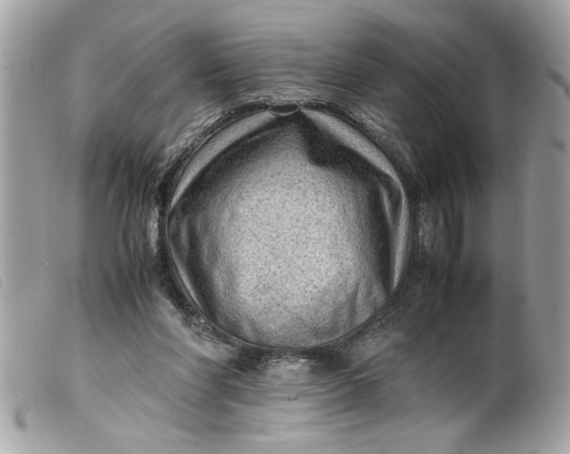 X0000099530206200805301447