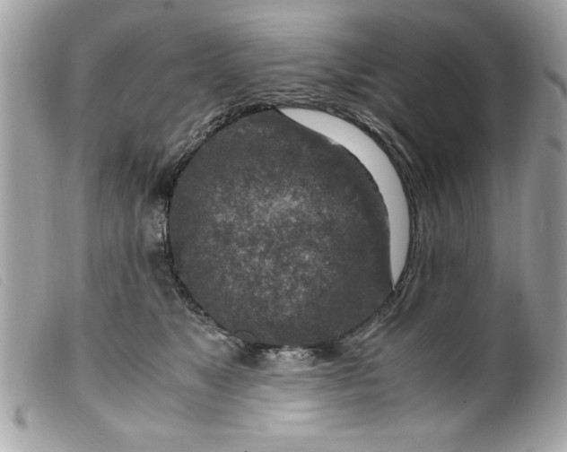 X0000099530517200805301443