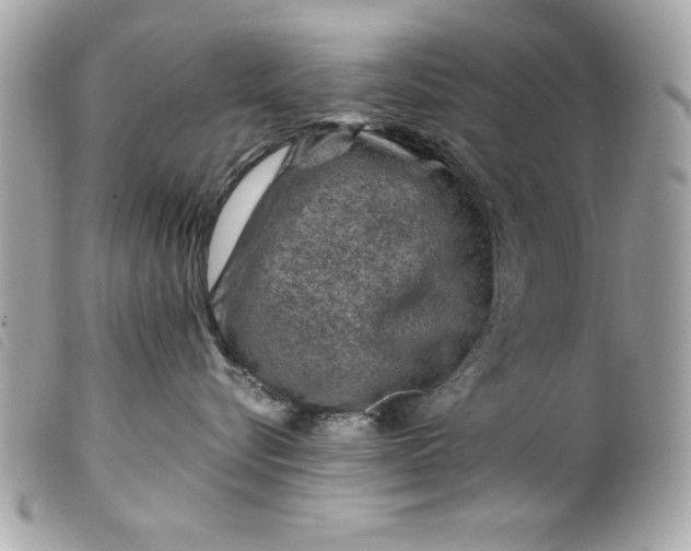 X0000099530576200805301442