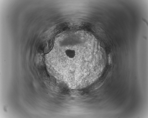 X0000099531059200805301435