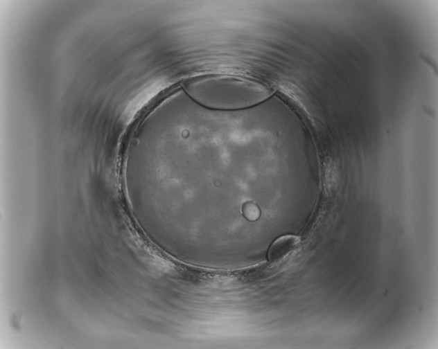 X0000099531071200805301435