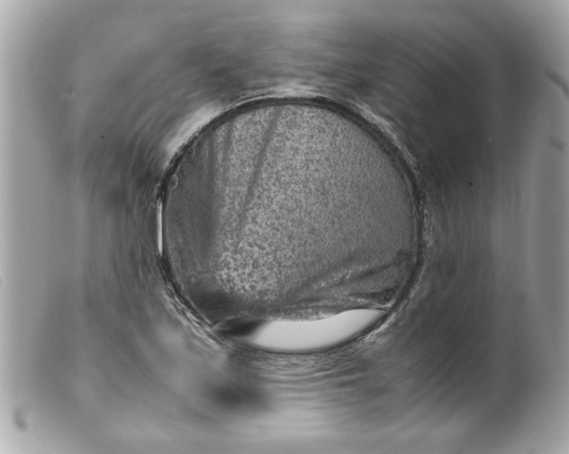 X0000099531171200805301433