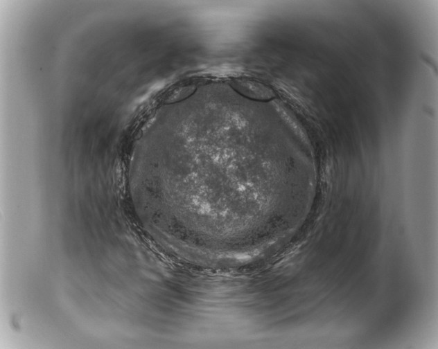 X0000099531398200805301430