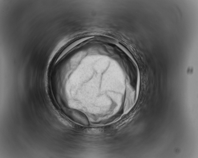 X0000099530102200806061441