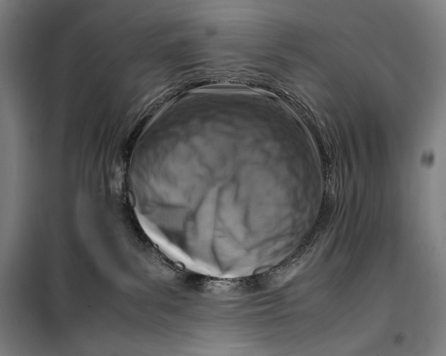 X0000099530139200806061440