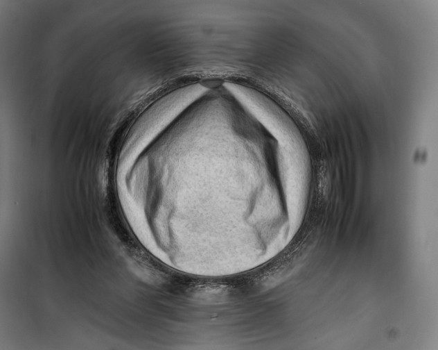 X0000099530206200806061439