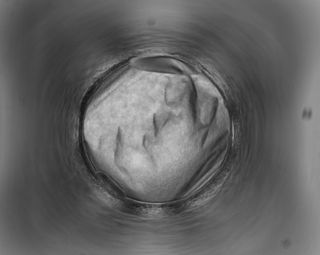 X0000099530301200806061438