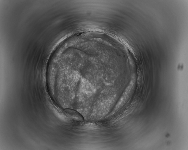 X0000099530390200806061436