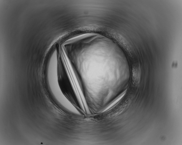 X0000099530396200806061436