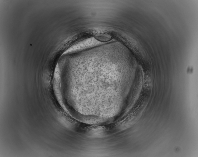 X0000099530456200806061435