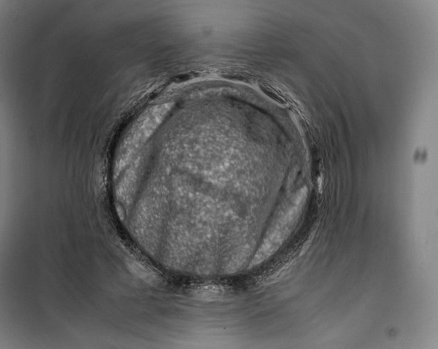 X0000099530593200806061433